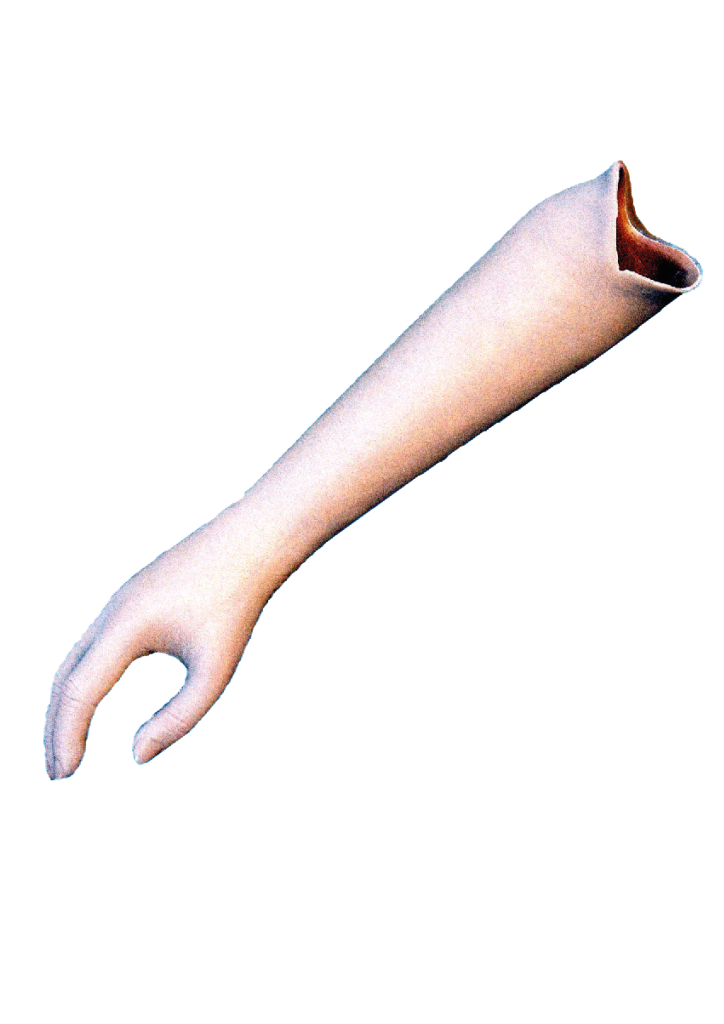PROTHESE D’AVANT BRAS