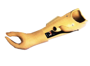 PROTHESE D’AVANT BRAS MYOELECTRIQUE