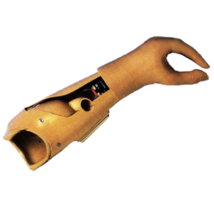 PROTHESE D’AVANT BRAS MYOELECTRIQUE